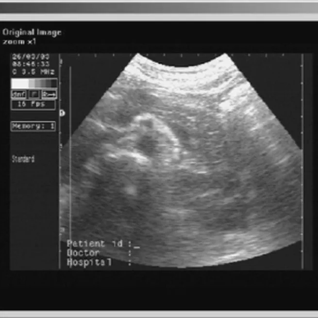 User Interface Environment and Image Communication in Mobile Tele-Echography