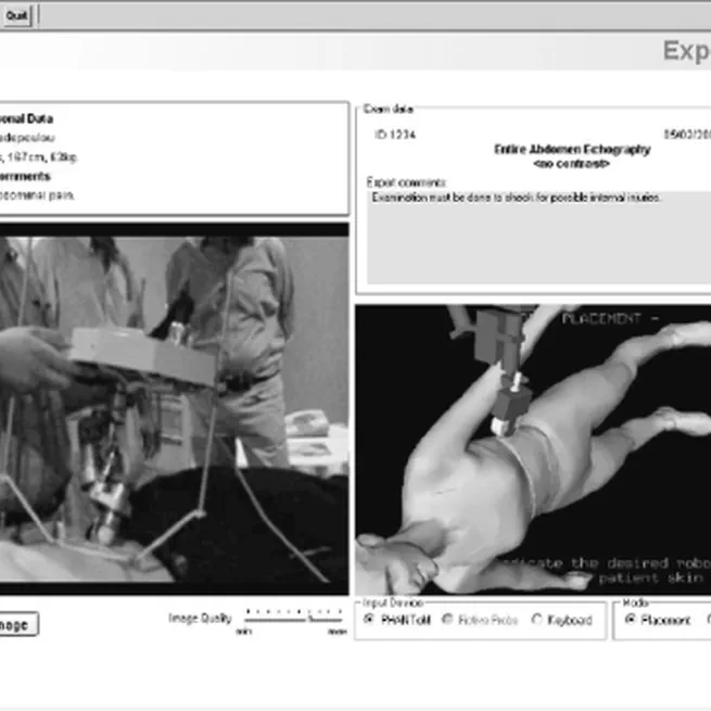 Mobile Tele-echography: User Interface Design